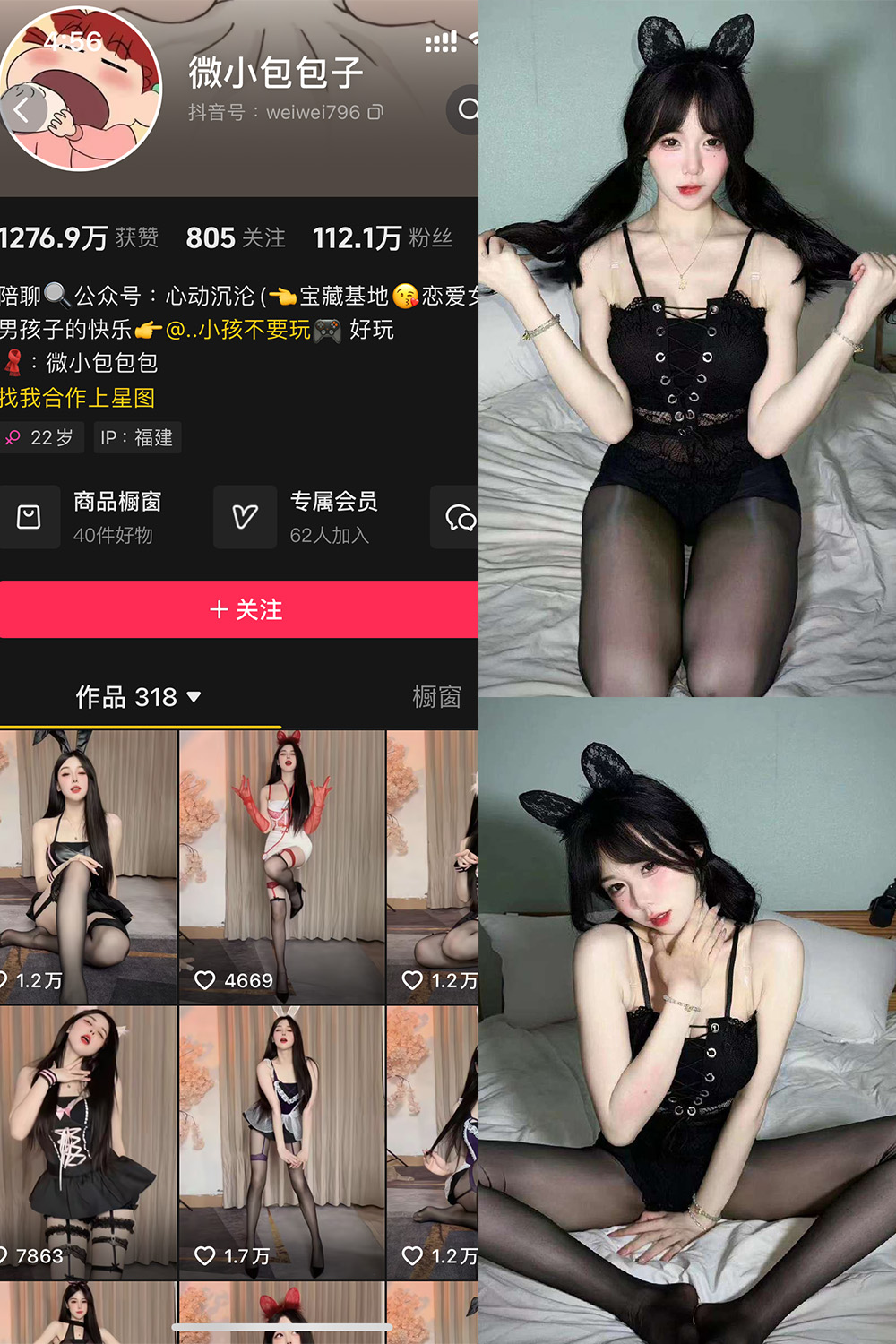 抖音 微小包包子 微密圈  NO.001期 【3V】