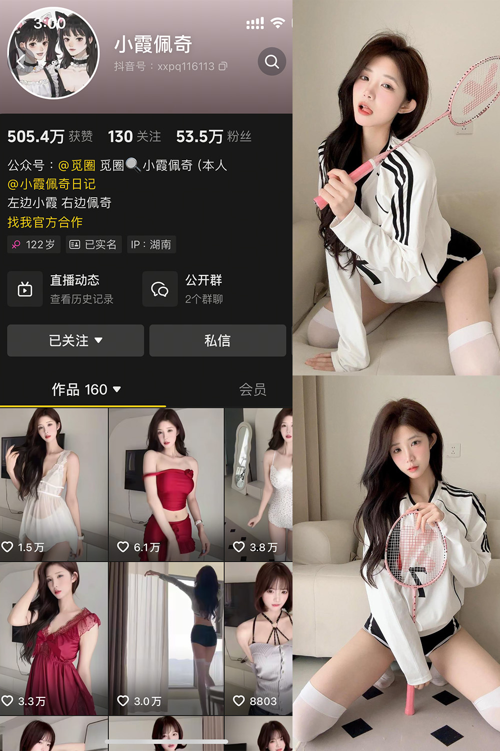 抖音 小霞佩奇 微密圈  NO.001期 【1V】