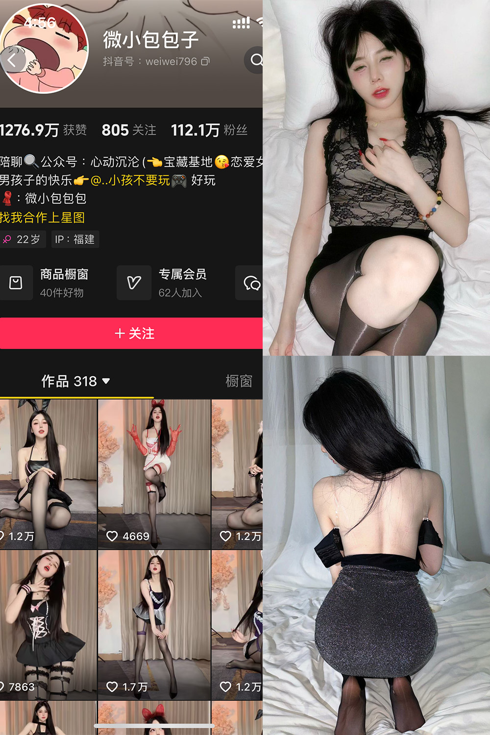 抖音 微小包包子 微密圈  NO.006期 【5V】最新至：2024.11.24